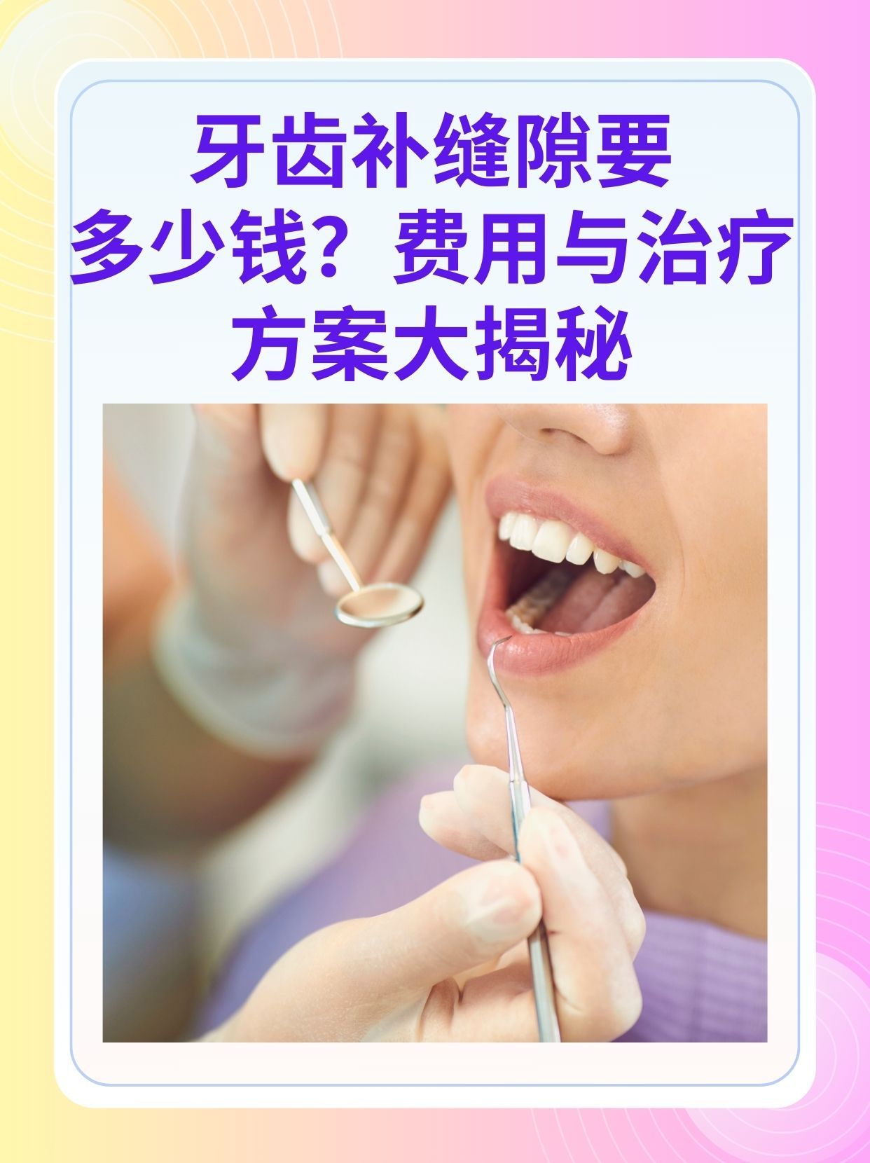 鄂州补牙医保可以报销吗(补牙医保可以报销吗 哪些可以报销呢)